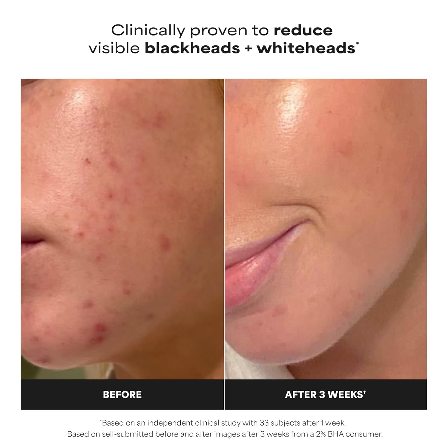 Paula's Choice SKIN PERFECTING 2% BHA Liquid Exfoliant with Salicylic Acid, Facial Polish for Pores, Wrinkles & Fine Lines, Suitable for Blackhead-Prone Skin, Fragrance-Free - Image 2
