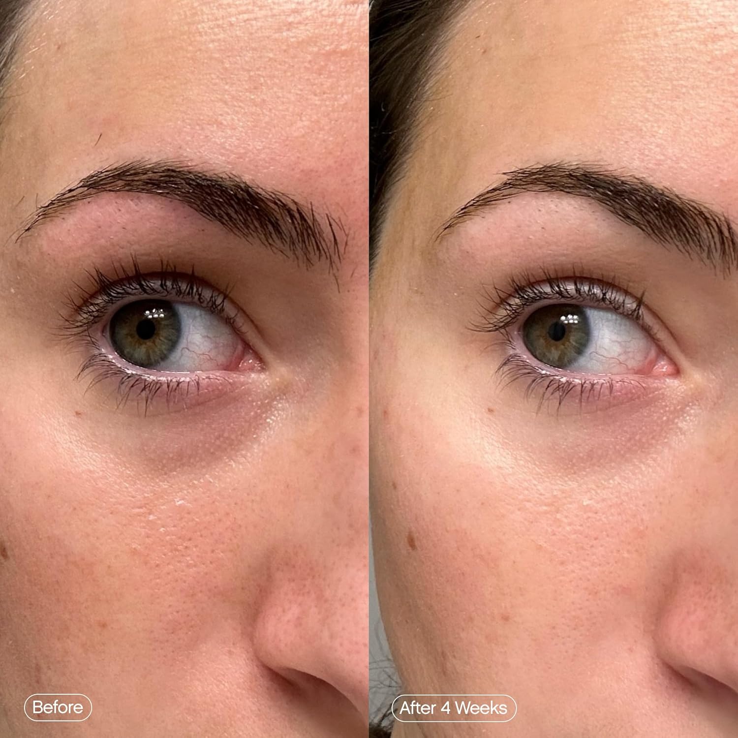 Topicals Faded Brightening Under Eye Masks | Patches to Depuff, Hydrate, Brighten and Cool | Reduce Dark Circles and Fine Lines | Contains Kojic Acid, Caffeine and Niacinamide (Set of 6) - Image 5