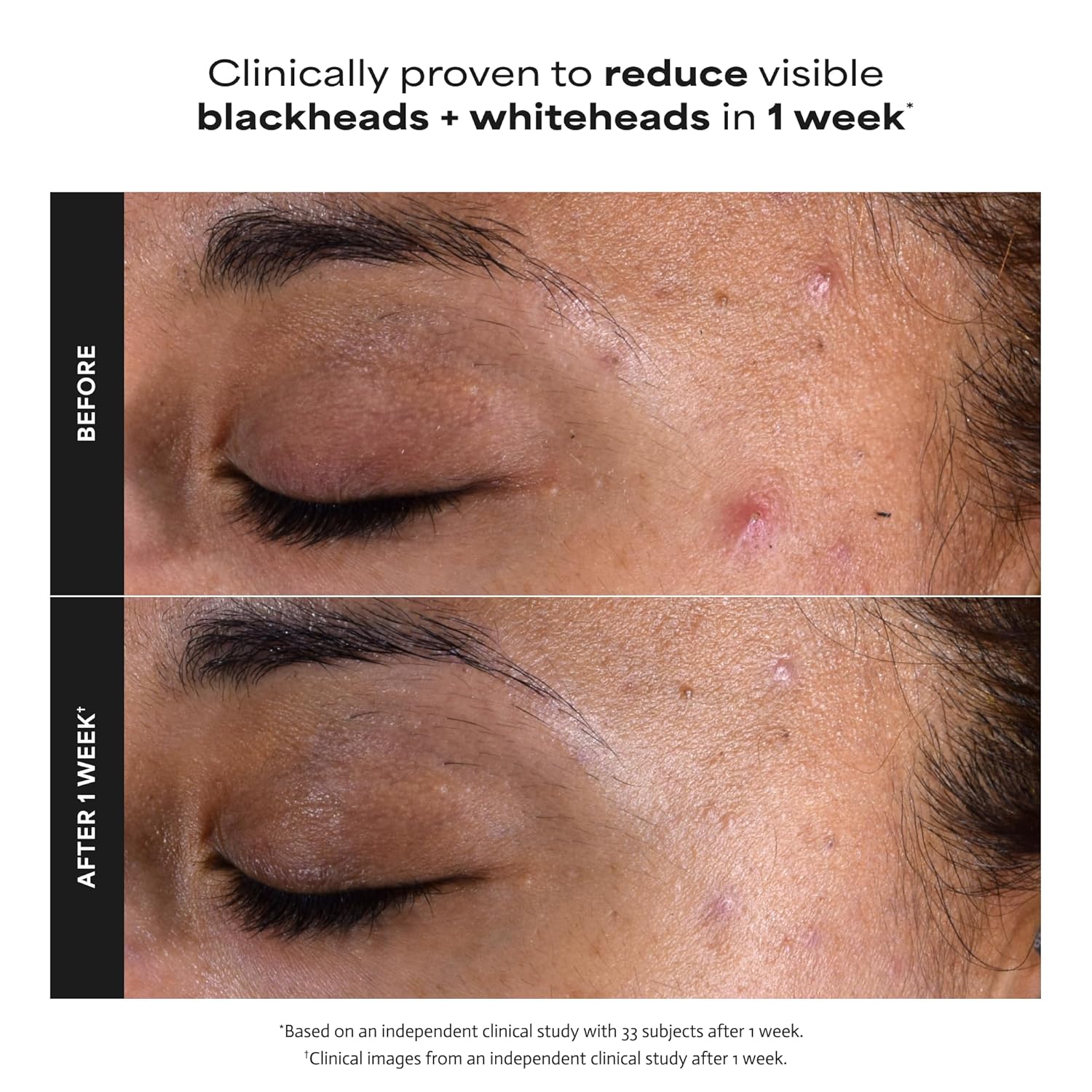 Paula's Choice SKIN PERFECTING 2% BHA Liquid Exfoliant with Salicylic Acid, Facial Polish for Pores, Wrinkles & Fine Lines, Suitable for Blackhead-Prone Skin, Fragrance-Free - Image 4