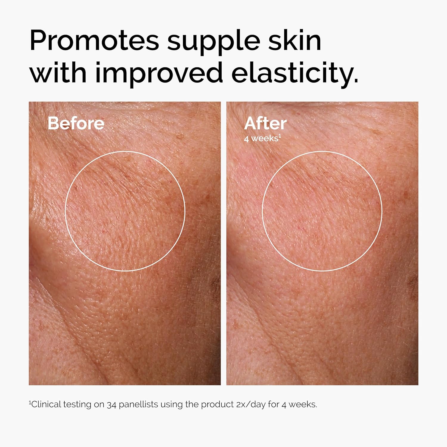 The Ordinary Hyaluronic Acid 2% + B5 (with Ceramides), Multi-Depth Hydration Serum for Plumper, Smoother Skin - Image 2