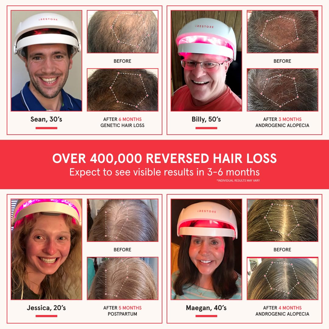iRestore Essential - Laser Red Light Therapy for Hair Growth - FDA Cleared Hair Loss, Hair Thinning & Alopecia Treatment for Men & Women - Laser Cap for Hair Regrowth Stimulate Denser Fuller Hair - Image 2