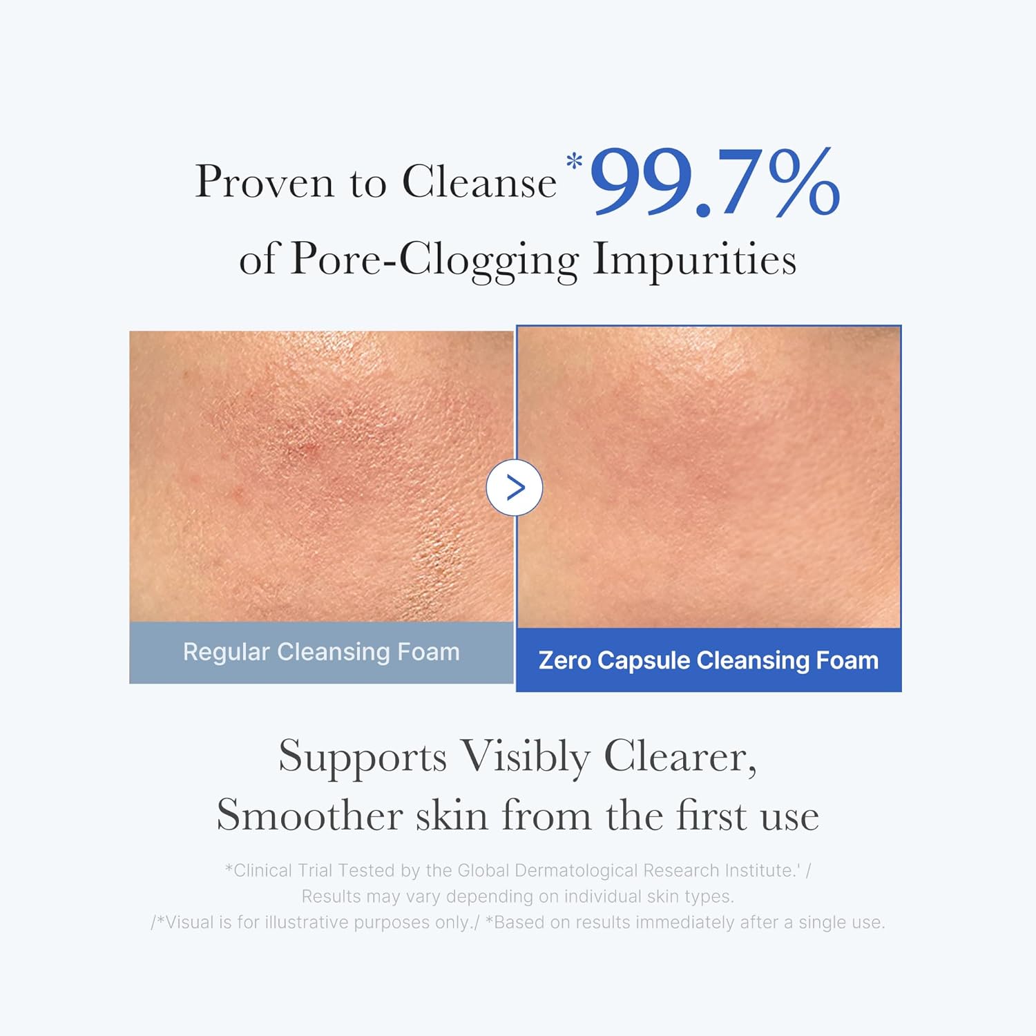 medicube Facial Cleanser Zero Pore Capsule Cleansing Foam | Daily Gentle Cleanser for Skin Texture, Blackhead & Pore Care | AHA, BHA & PHA for Deep Cleansing | Korean Skincare, 4.23 oz - Image 3
