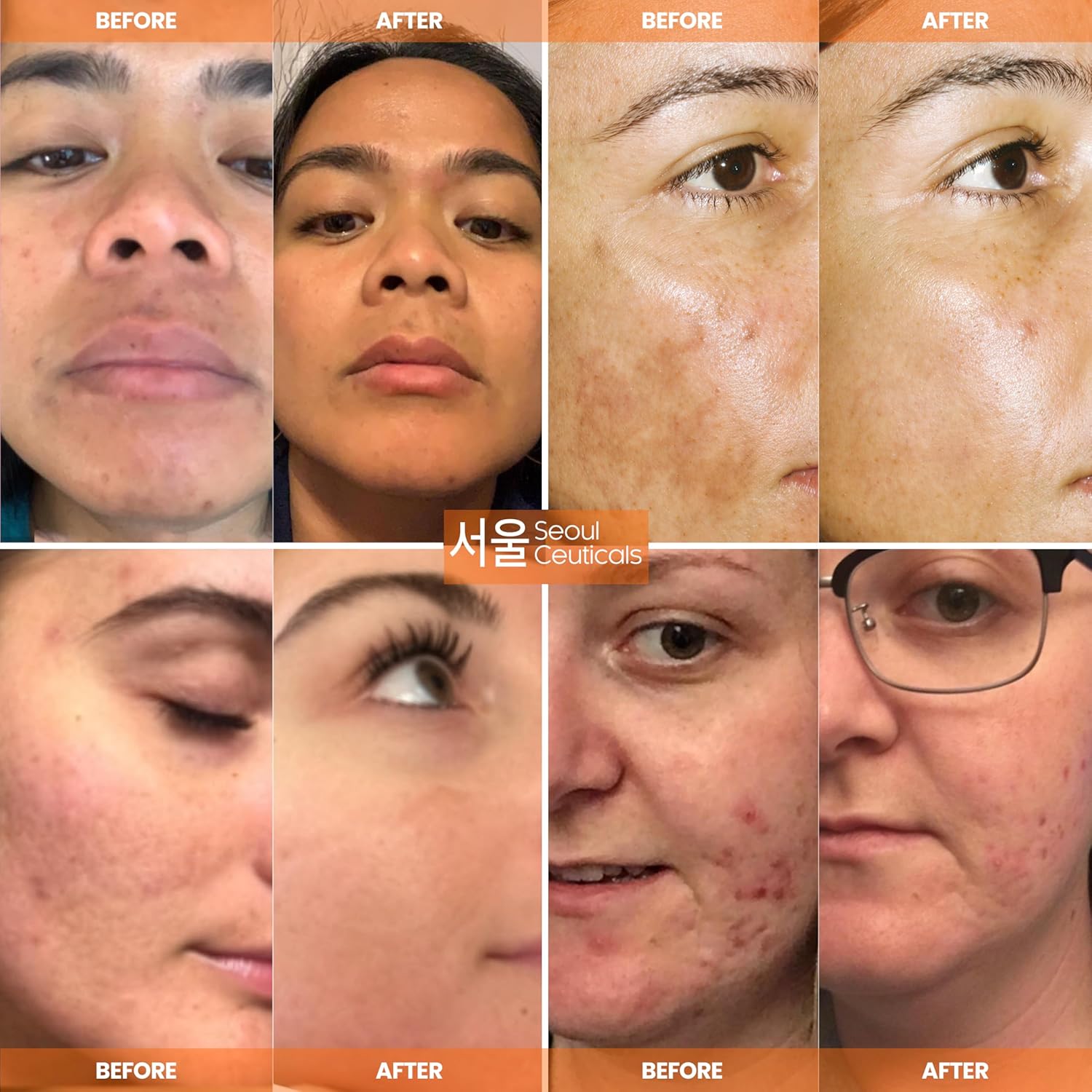 SeoulCeuticals Korean Skin Care Korean- 20% Vitamin C Hyaluronic Acid Serum + CE Ferulic Acid - Potent Anti Aging, Anti Wrinkle Korean Beauty 1oz - Image 3