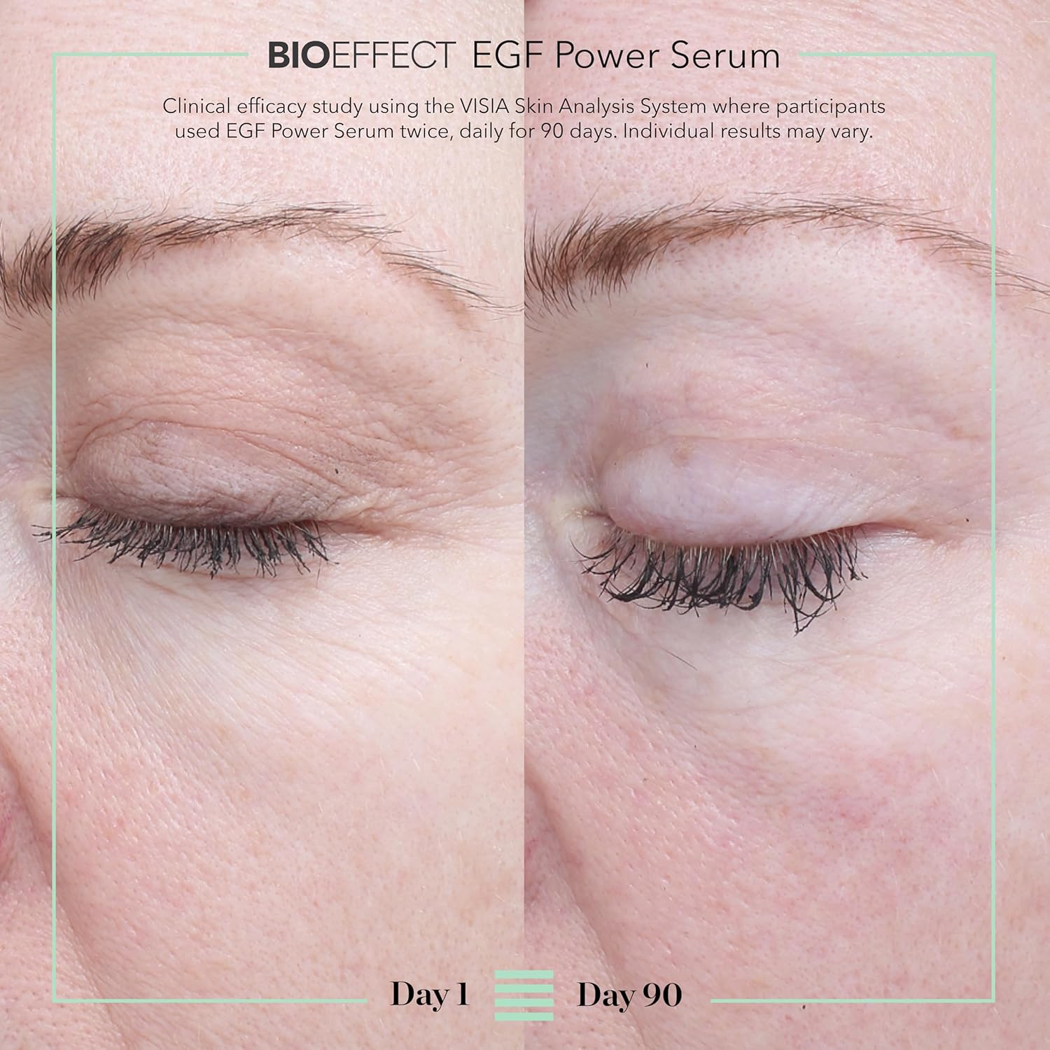 BIOEFFECT EGF Power Serum | Epidermal Growth Factor + KGF + Hyaluronic Acid | Intensive Age-Defying Face Treatment for Deep Wrinkles, Firmness & Skin Renewal, 15 mL / 0.50 oz - Image 4