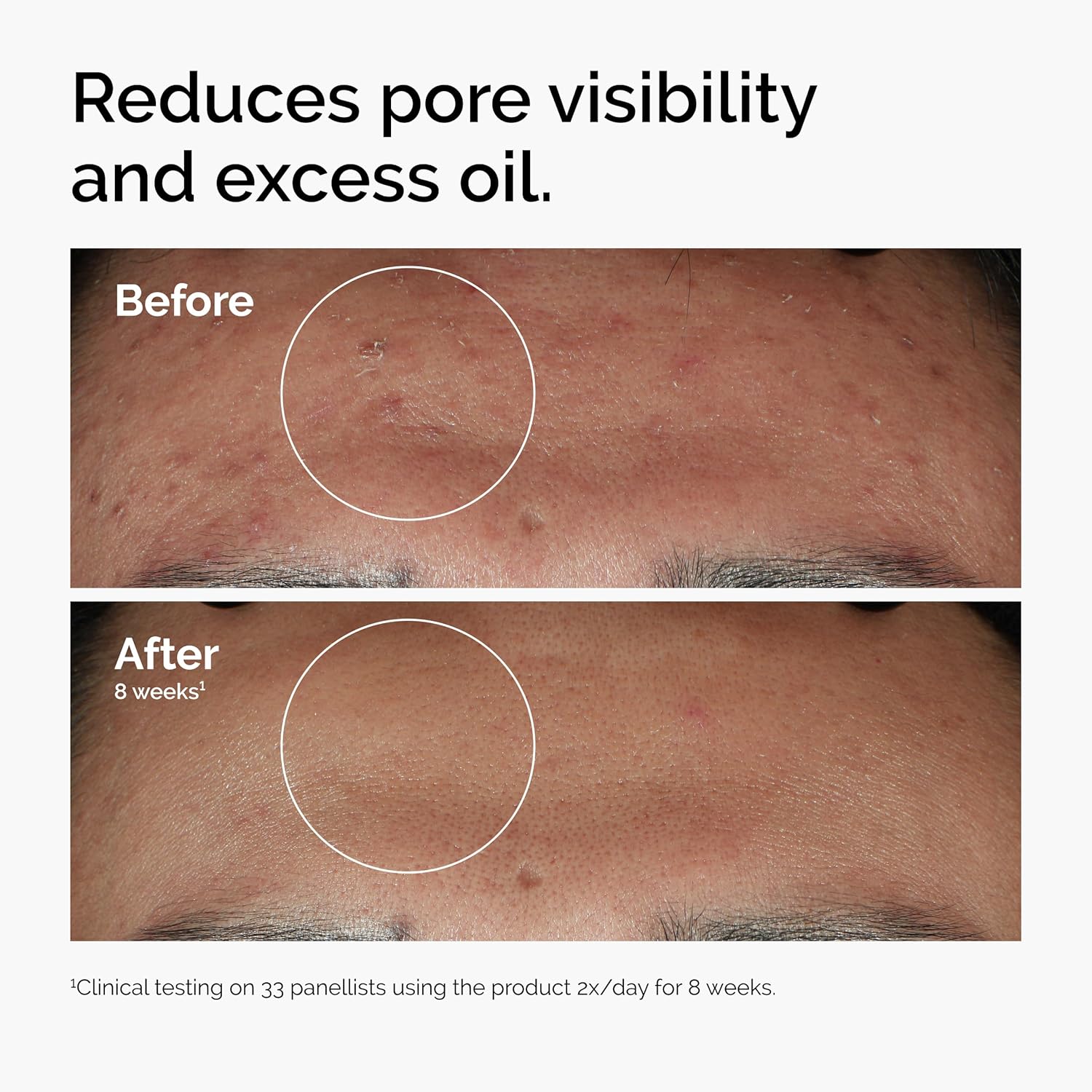 The Ordinary Serum Favorites Set – Hyaluronic Acid 2% + B5, Niacinamide 10% + Zinc 1%, Caffeine Solution 5% – Eye and Face Serums for Hydrating, Brightening & Pore-Minimizing Skin Care - Image 6