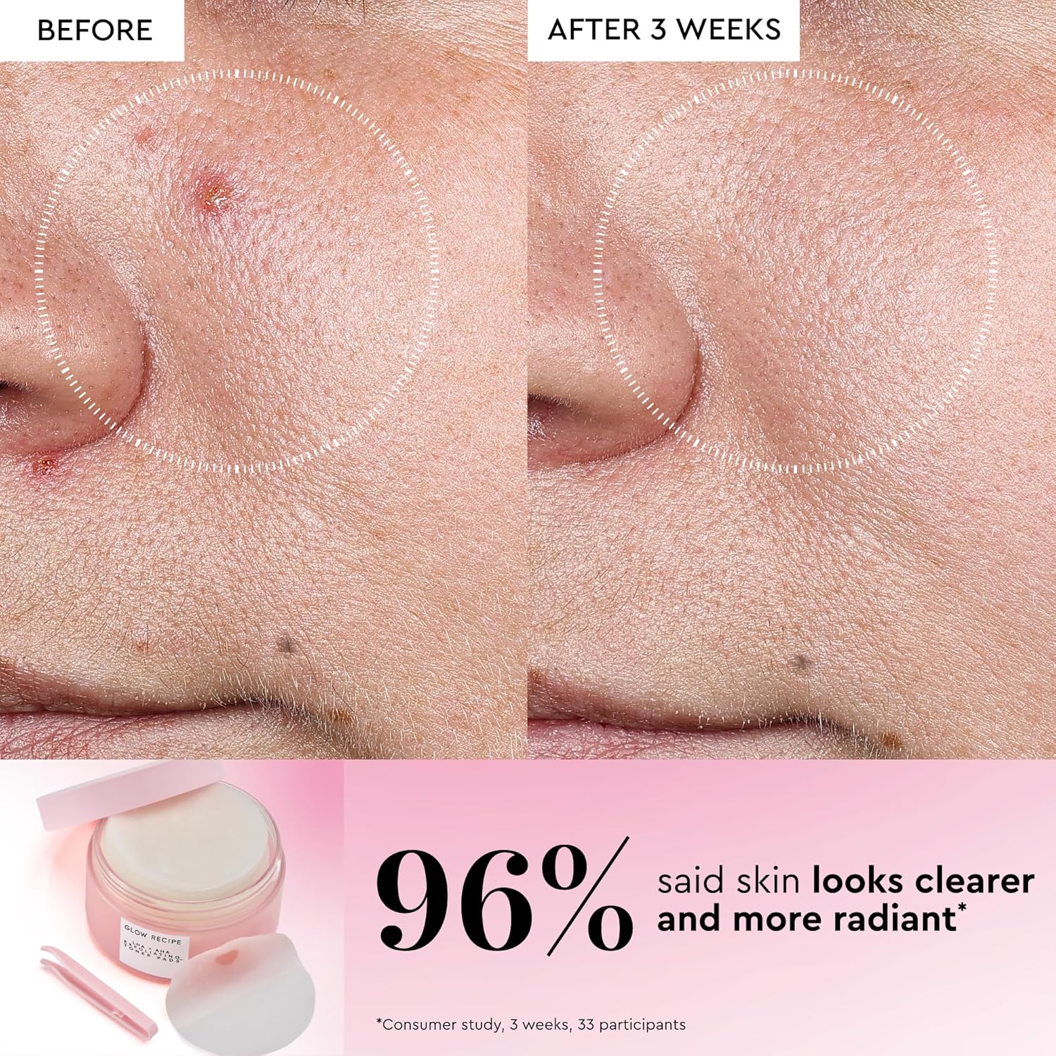 Glow Recipe LHA + AHA Toner Pads - Korean Exfoliating Toner for Face - Pore Minimizer - Hydrating Toner Pads - 5 Gentle Acids, Watermelon Enzymes, Hydrating Botanicals (60 Face Pads) - Image 4