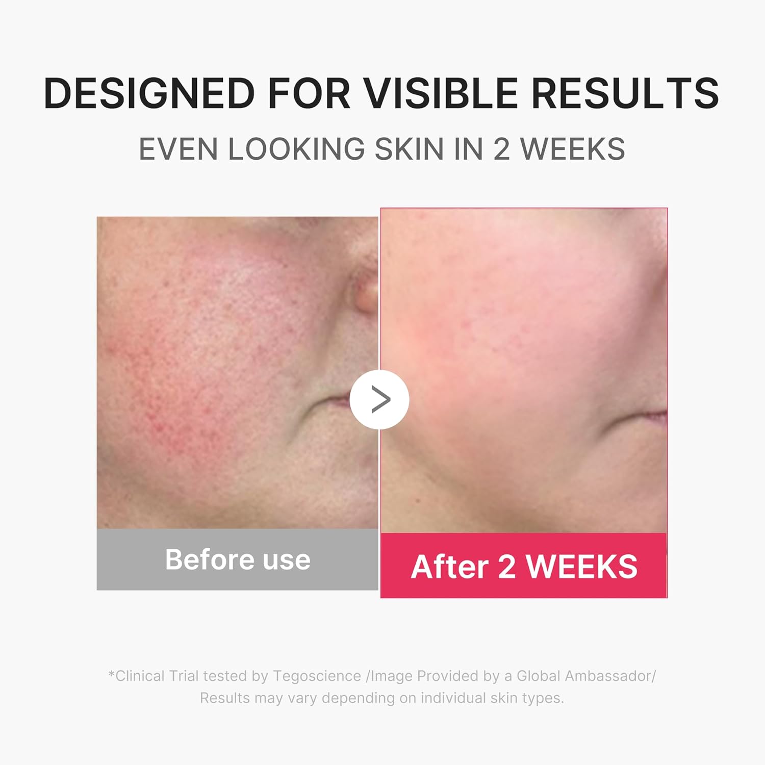 medicube Mini Booster Pro Plus | Facial Device for Radiant, Calming, and Bouncy-Looking Skin | Red, Blue, Purple 3-Mode | Portable Korean Skincare Device, At Home Care | Pink - Image 6