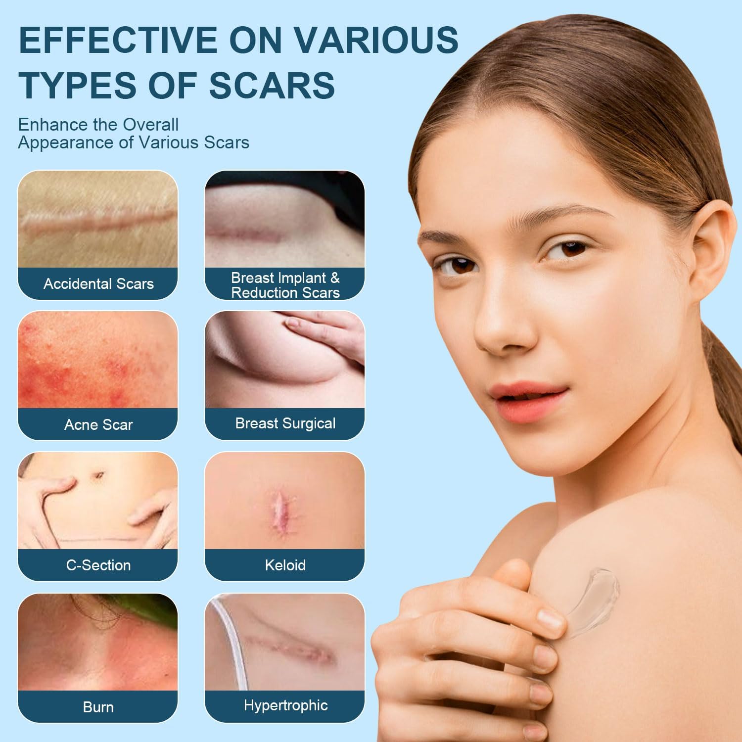 Mitgary Advanced Scar Gel, Silicone Scar Gel, Treats Old and New Scars, Reduces the Appearance of Scars from, Body, Face, Stretch Marks, Surgical Scar, Keloids, Acne, Burns and More, 50g (1.7 Oz) - Image 5