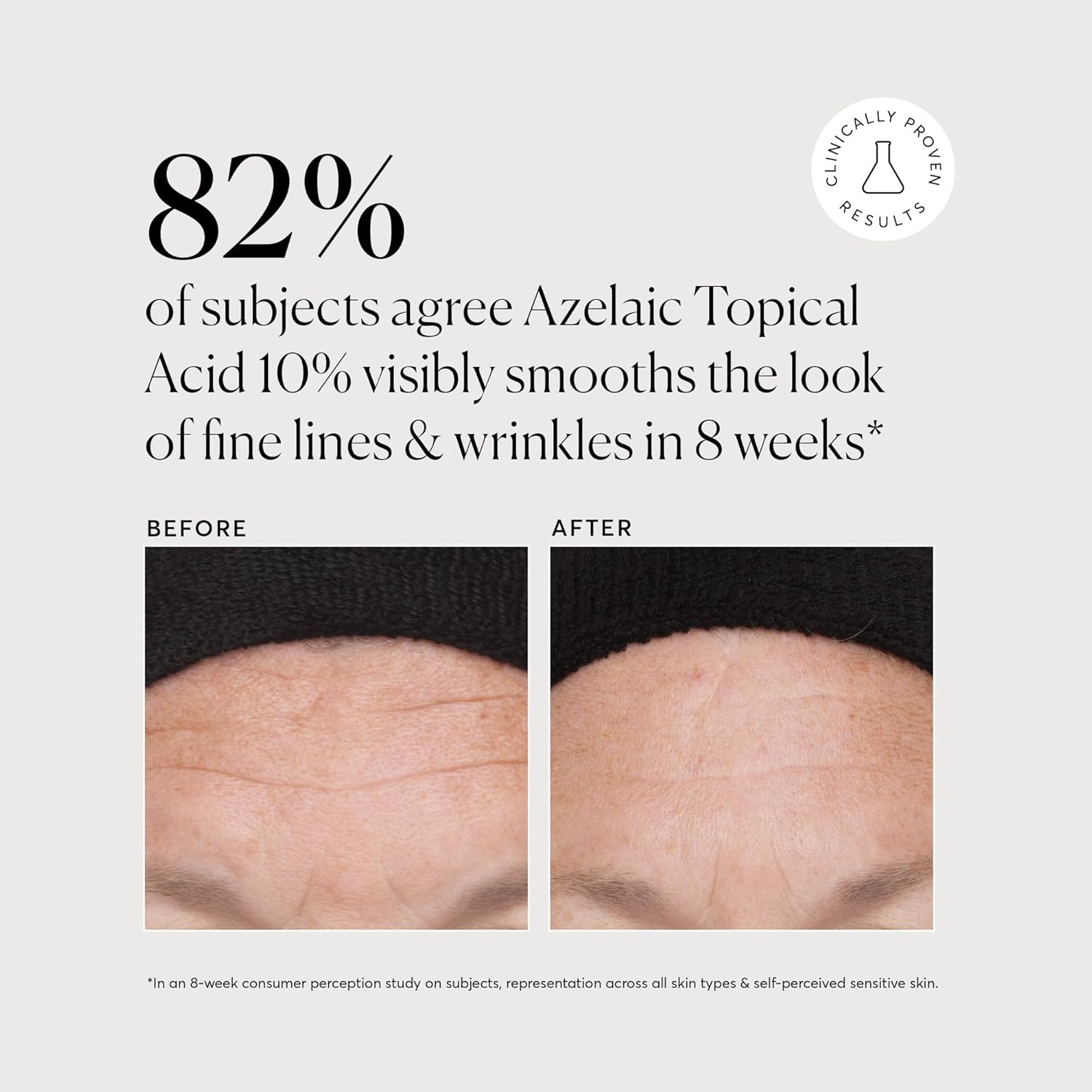 Naturium Azelaic Topical Acid 10% Jumbo, Face & Skin Care Beauty Treatment with Niacinamide & Vitamin C, 2 oz - Image 5