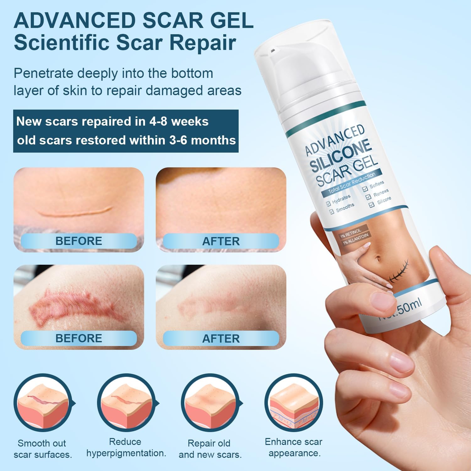 Mitgary Advanced Scar Gel, Silicone Scar Gel, Treats Old and New Scars, Reduces the Appearance of Scars from, Body, Face, Stretch Marks, Surgical Scar, Keloids, Acne, Burns and More, 50g (1.7 Oz) - Image 4