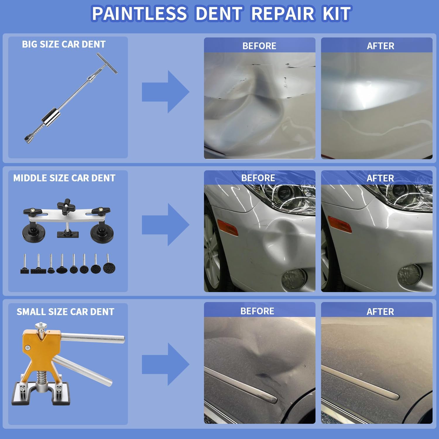 97PCS Auto Body Dent Repair Tool Kit, Paint-Friendly Dent Repair Kit with Golden Lifter, Slide Hammer T-bar Dent Puller, Bridge Puller, Suction Cup and Glue Gun for Car Dent Remove Tools Kit - Image 4